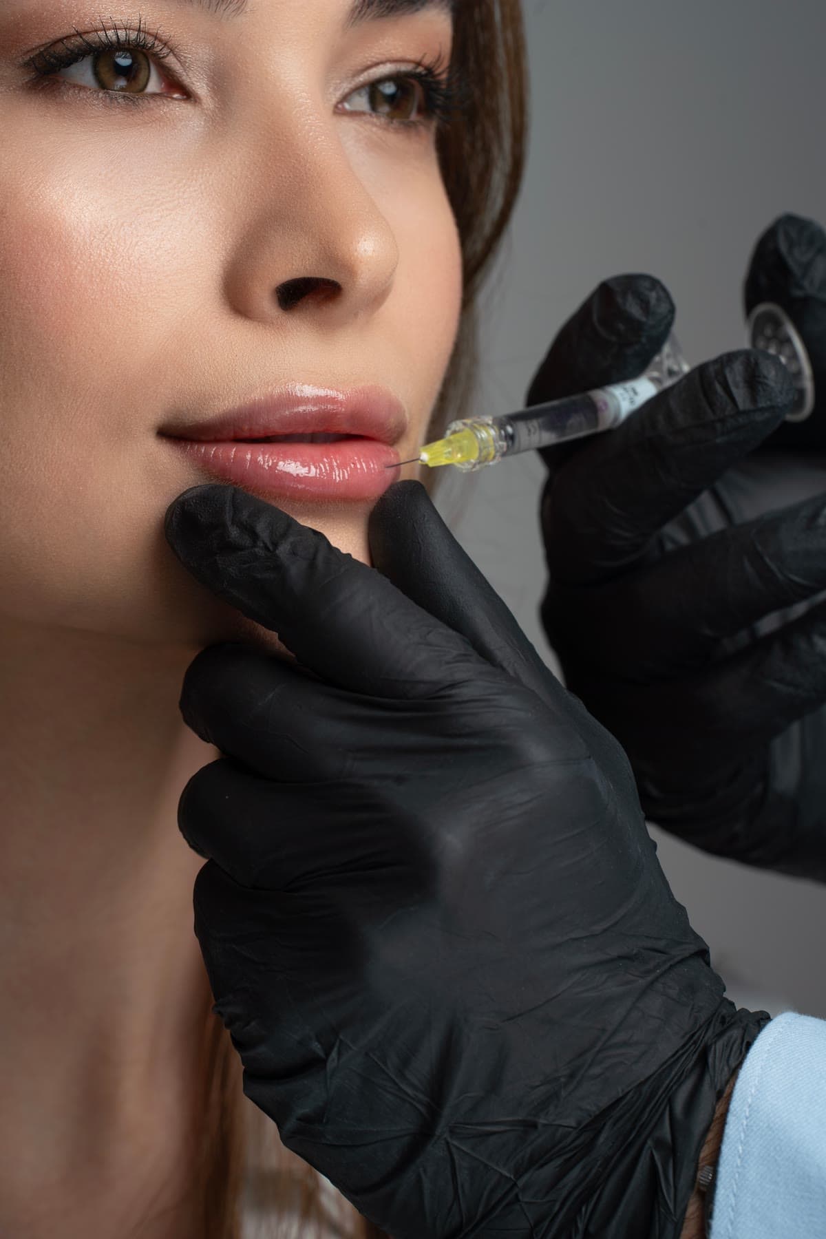 Medico che esegue un trattamento filler alle labbra